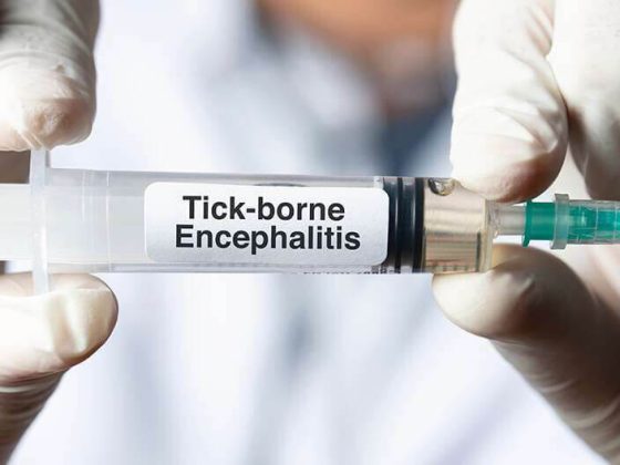 Tick-Borne Encephalitis (FSME) Vaccine